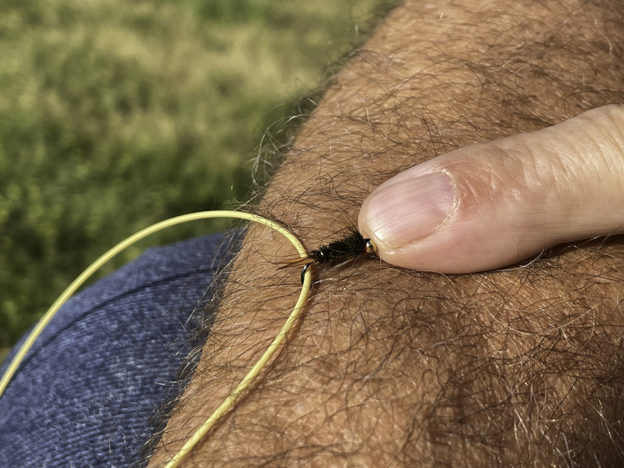 removing fish hooks from anglers