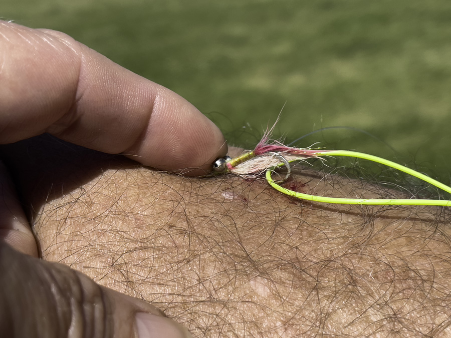 removing fish hooks from anglers